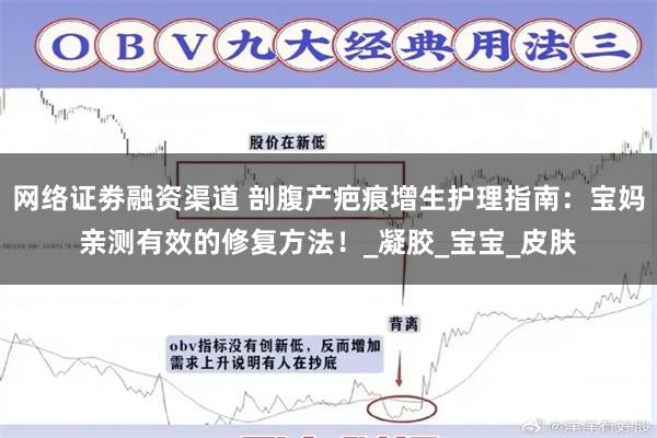 网络证劵融资渠道 剖腹产疤痕增生护理指南：宝妈亲测有效的修复方法！_凝胶_宝宝_皮肤
